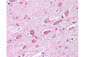 Anti-MC4 Receptor antibody IHC of human brain. (MC4R antibody  (N-Term))