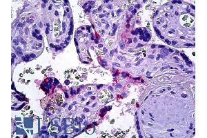 Immunohistochemistry (IHC) image for anti-Docking Protein 3 (DOK3) (C-Term) antibody (ABIN184642)