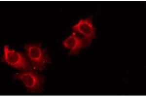 ABIN6274806 staining HeLa by IF/ICC. (ACOT4 antibody  (C-Term))