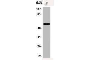 Western Blot analysis of 293 cells using Phospho-c-Myc (T58) Polyclonal Antibody (c-MYC antibody  (pThr58))