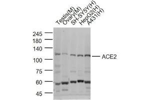 Lane 1: Mouse Testis lysates; Lane 2:Mouse Ovary lysates; Lane 3: SH-SY5Y cell lysates; Lane 4: HepG2 cell lysates; Lane 5: A431 cell lysates probed with ACE2 Polyclonal Antibody, Unconjugated (bs-23444R) at 1:1000 dilution and 4˚C overnight incubation. (ACE2 antibody  (AA 351-450))