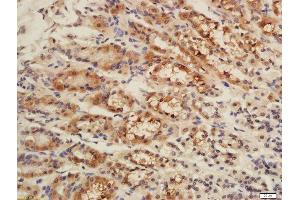 Formalin-fixed and paraffin embedded rat stomach labeled with Rabbit Rabbit Anti-CISD1 Polyclonal Antibody, Unconjugated (ABIN2173059) at 1:200 followed by conjugation to the secondary antibody and DAB staining