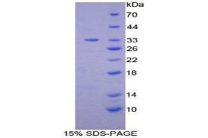 SDS-PAGE (SDS) image for Diacylglycerol Kinase, epsilon 64kDa (DGKE) (AA 243-502) protein (His tag) (ABIN2124623) (DGKE Protein (AA 243-502) (His tag))