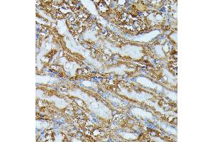 Immunohistochemistry of paraffin-embedded mouse kidney using IVD antibody (ABIN7268031) at dilution of 1:100 (40x lens). (IVD antibody  (AA 33-200))