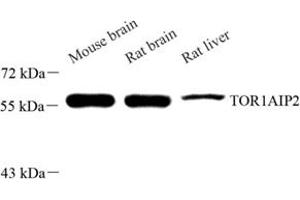 Western blot analysis of TOR1AIP2 (ABIN7075941) at dilution of 1: 500 (TOR1AIP2 antibody)