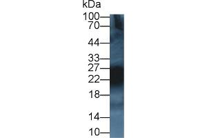 Detection of CD99 in Rat Thymus lysate using Polyclonal Antibody to Cluster Of Differentiation 99 (CD99) (CD99 antibody  (AA 26-160))