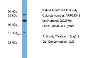 WB Suggested Anti-TLK2  Antibody Titration: 0. (TLK2 antibody  (N-Term))