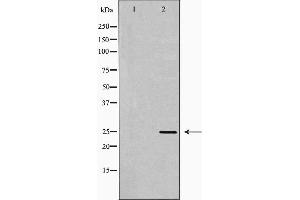 Western blot analysis of lovo cell lysate, using RAN Antibody. (RAN antibody  (C-Term))