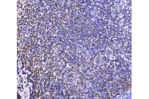 IHC analysis of AHR using anti-AHR antibody (ABIN6719265). (Aryl Hydrocarbon Receptor antibody)