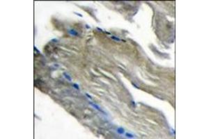 Image no. 2 for anti-Phosphoinositide-3-Kinase, Catalytic, gamma Polypeptide (PIK3CG) (C-Term) antibody (ABIN360712)