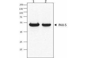 Western Blotting (WB) image for anti-Paired Box 5 (PAX5) antibody (ABIN2667347) (PAX5 antibody)