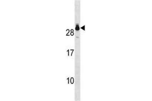 GSTT2 antibody western blot analysis in A549 lysate.