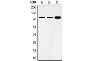 Western blot analysis of FOXO1 (pS319) expression in MCF7 (A), HeLa (B), NIH3T3 (C) whole cell lysates. (FOXO1 antibody  (pSer319))