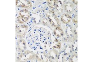 NEDD4-2 antibody  (AA 836-955)