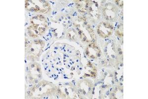 Immunohistochemistry of paraffin-embedded rat kidney using NEDD4L antibody (ABIN6132407, ABIN6144504, ABIN6144505 and ABIN6224109) at dilution of 1:200 (40x lens). (NEDD4-2 antibody  (AA 836-955))