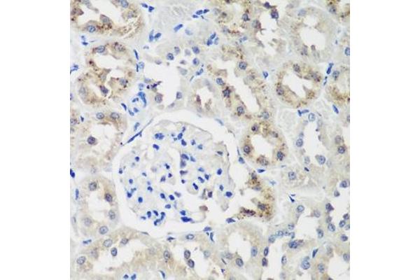 NEDD4-2 antibody  (AA 836-955)