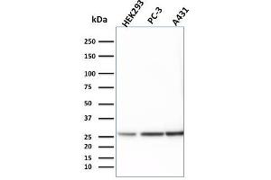 Western Blot Analysis of HEK293, PC-3 and A431 cell lysates using 14-3-3E Mouse Monoclonal Antibody (CPTC-YWHAE-1). (YWHAE antibody)