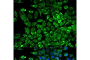 Immunofluorescence analysis of A549 cells using ALDOA Polyclonal Antibody (ALDOA antibody)