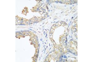 Immunohistochemistry of paraffin-embedded human prostate using CBL antibody. (CBL antibody)