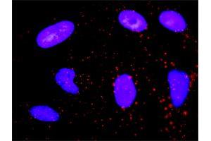 Proximity Ligation Analysis of protein-protein interactions between CDK6 and CDKN1B. (CDK6 antibody  (AA 1-326))