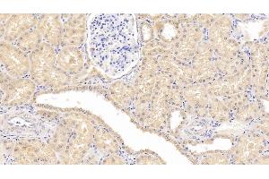 Detection of Hsp60 in Human Kidney Tissue using Monoclonal Antibody to Heat Shock Protein 60 (Hsp60) (HSPD1 antibody  (AA 1-573))