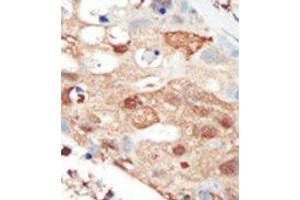 Image no. 2 for anti-Phosphoinositide 3 Kinase, p85 beta (PI3K p85b) (C-Term) antibody (ABIN360460) (PIK3R2 antibody  (C-Term))