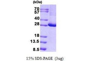 Image no. 1 for Potassium Channel Tetramerisation Domain Containing 11 (KCTD11) protein (His tag) (ABIN7280167)
