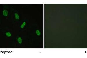 Immunofluorescence analysis of HeLa cells, using AR polyclonal antibody . (Androgen Receptor antibody)
