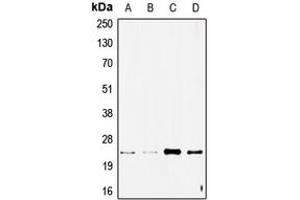 Western blot analysis of STMN2 expression in SHSY5Y (A), NIH3T3 (B), A549 (C), rat brain (D) whole cell lysates. (STMN2 antibody  (Center))