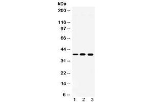 Western blot testing of 1) rat spleen, 2) mouse ANA-1 and 3) human Jurkat lysate with LDHA antibody at 0.