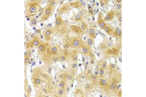 Immunohistochemistry of paraffin-embedded Human liver injury using EIF4G1 antibody at dilution of 1:100 (x400 lens).