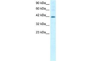 Human Jurkat; WB Suggested Anti-MIER1 Antibody Titration: 1. (MIER1 antibody  (Middle Region))