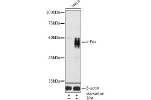 Western blot analysis of extracts of HeLa cells, using c-Fos antibody (ABIN6134024, ABIN6137712, ABIN6137713 and ABIN6219544) at 1:1000 dilution. (c-FOS antibody  (AA 90-190))