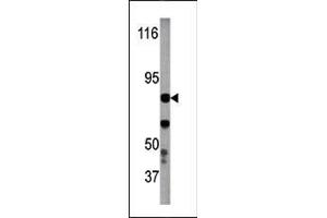 Image no. 1 for anti-Inhibitor of kappa Light Polypeptide Gene Enhancer in B-Cells, Kinase beta (IKBKB) (pTyr199) antibody (ABIN358141)