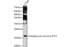 Western blot analysis of extracts of Jurkat cells, using Parathyroid Hormone (PTH) (PTH) Rabbit mAb (ABIN7269175) at 1:1000 dilution. (PTH antibody)