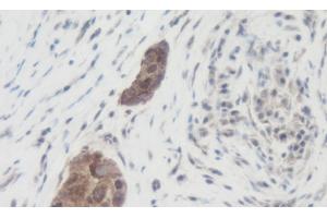 Immunohistochemistry (IHC) image for anti-Wingless-Type MMTV Integration Site Family, Member 1 (WNT1) antibody (ABIN2477142) (WNT1 antibody)