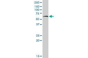 PAPSS2 MaxPab rabbit polyclonal antibody. (PAPSS2 antibody  (AA 1-614))