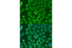 Immunofluorescence analysis of U2OS cells using ZFYVE16 antibody (ABIN2737838) at dilution of 1:100. (ZFYVE16 antibody)