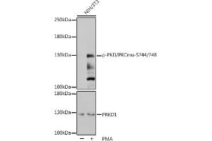 Western blot analysis of extracts of NIH/3T3 cells, using Phospho-PKC mu-S744/748 pAb (ABIN7269641) at 1:1000 dilution or PRKD1 antibody (ABIN7269644). (PKC mu antibody  (pSer744, pSer748))