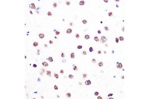 Immunohistochemistry of paraffin-embedded mouse brain using 53BP1 Rabbit mAb (ABIN1679832, ABIN3018199, ABIN3018200 and ABIN7101582) at dilution of 1:100 (40x lens).
