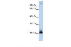 Image no. 1 for anti-Integrin beta 3 Binding Protein (Beta3-Endonexin) (ITGB3BP) (AA 36-85) antibody (ABIN6739036) (ITGB3BP antibody  (AA 36-85))