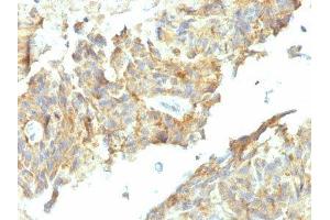 Image no. 2 for anti-Alkaline Phosphatase (ALP) antibody (ABIN6155884) (Alkaline Phosphatase antibody)