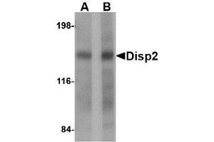 Image no. 1 for anti-Dispatched Homolog 2 (DISP2) (C-Term) antibody (ABIN341692) (DISP2 antibody  (C-Term))