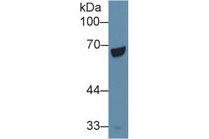 Detection of PCK1 in Human Liver lysate using Polyclonal Antibody to Phosphoenolpyruvate Carboxykinase 1, Soluble (PCK1) (PCK1 antibody  (AA 311-558))