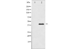 Western blot analysis of MKK3 expression in MDA-MB-435 whole cell lysates,The lane on the left is treated with the antigen-specific peptide. (MAP2K3 antibody  (Internal Region))
