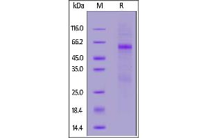 SDS-PAGE (SDS) image for SARS-CoV-2 Nucleocapsid (SARS-CoV-2 N) (G204R), (R203K) (Active) protein (His tag) (ABIN6992418)