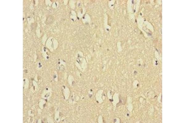 VPS33B antibody  (AA 348-617)