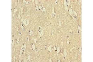 Immunohistochemistry of paraffin-embedded human brain tissue using ABIN7175313 at dilution of 1:100 (VPS33B antibody  (AA 348-617))