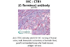 Image no. 1 for anti-Solute Carrier Family 31 (Copper Transporters), Member 1 (SLC31A1) (C-Term) antibody (ABIN1733362) (SLC31A1 antibody  (C-Term))