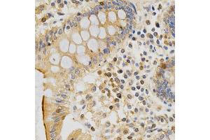 Immunohistochemistry of paraffin-embedded human colon using PRKCE antibody (ABIN5971136) at dilution of 1/200 (40x lens).